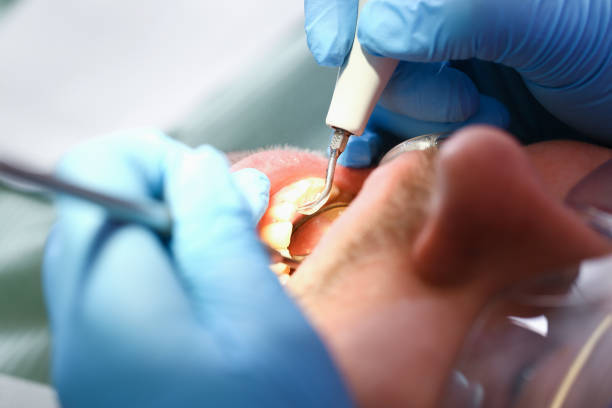 Best Emergency Treatment for Toothache in Burlington, WI